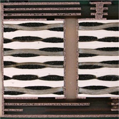 Laser 3 giai đoạn thông qua bảng HDI